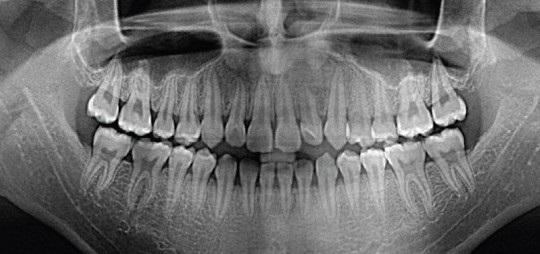 Компьютерная томография зубов - где сделать?