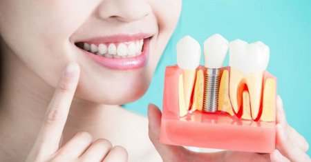 Когда протезирование зубов невозможно?